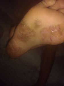 Crowdfunding - Campanha beneficente em prol da Ana 