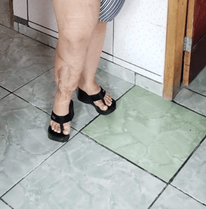 Vaquinha Online - Cirurgia plástica da perna da minha mãe 