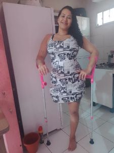 Vaquinha Online - Vaquinha para comprar minha perna mecânica 