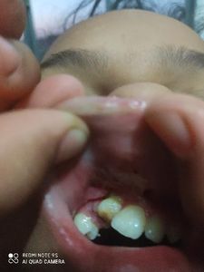 Saúde e Emergências - soriso da ludymilla