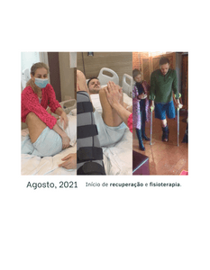 Jundiaí/SP - Prótese para o Victor