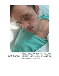 Victor Guilherme @vktorgui - Prótese para o Victor