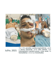 Crowdfunding - Prótese para o Victor