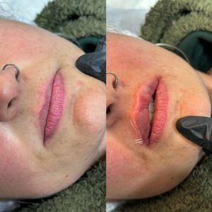 Crowdfunding - Levantar fundos para montar minha própria clínica de estetica 