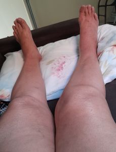 Vaquinha Online - "Minha saúde pede socorro "