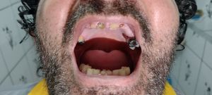 Saúde e Emergências - Comi meus próprios dentes 