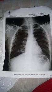 Vaquinha - Ajuda para Jeff 