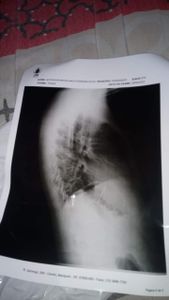 Campanha para Jeff  - Ajuda para Jeff 