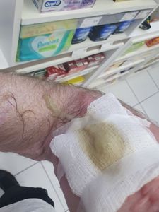 Santa Maria/RS - Meu Braço Direito Pede Ajuda