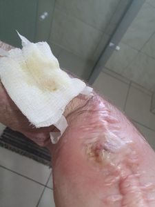 Melhoras Ander - Meu Braço Direito Pede Ajuda