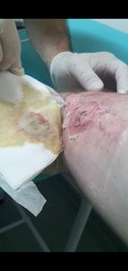 Financiamento Coletivo - Meu Braço Direito Pede Ajuda