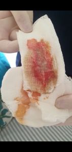 Meu Braço Direito Pede Ajuda imagem 6