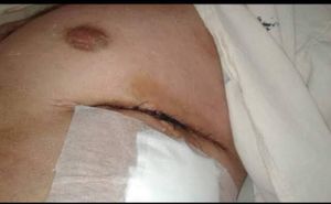 Vaquinha Online - Tratamento dentário