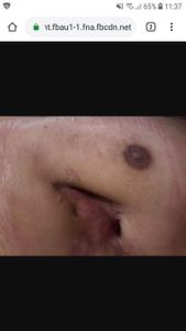 Saúde e Emergências - Tratamento dentário