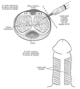 Crowdfunding - Aumento peniano  no Brasil 
