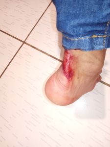 Vaquinha Online - Ajuda para comprar uma bicicleta para trabalhar