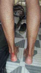 Jaboatão dos Guararapes/PE - Ajuda para comprar uma bicicleta para trabalhar