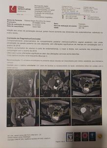 Rafaela Bagno - Cirurgia