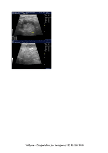 Ajuda para a cirurgia para remoção do câncer da Manu imagem 10