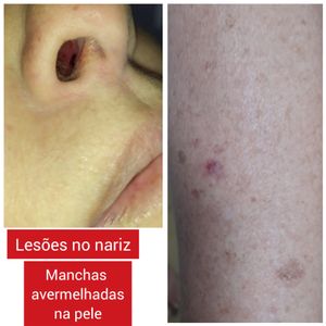 Ajude no tratamento da Ana imagem 9