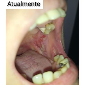 Ajude no tratamento da Ana imagem 6