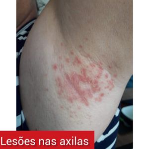 Londrina/PR - Ajude no tratamento da Ana