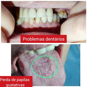 Ajude no tratamento da Ana imagem 8