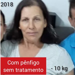 Vaquinha - Ajude no tratamento da Ana