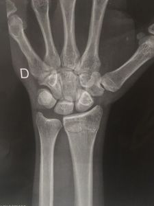 Erik Pereira - Ajuda Erik Pereira