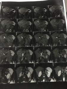 Maria Aparecida Brito Santos  - Preciso fazer CPRE urgente !