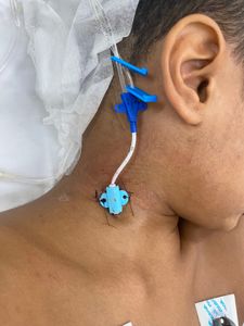 Vaquinha Online - Luta pela cura do Joãozinho 