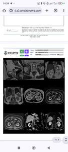 AJUDE O ALESSANDRO NA CIRURGIA CONTRA O CANCER imagem 6