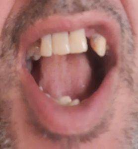 Vaquinha Online - Tratamento urgente