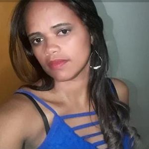 Vaquinha Online - Ajude Deusimar Rodrigues (Mazinha) fazer a cirurgia - Sem vaga SUS
