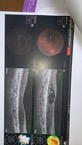 Vaquinha Online - Ajude a Patty a continuar enxergar 