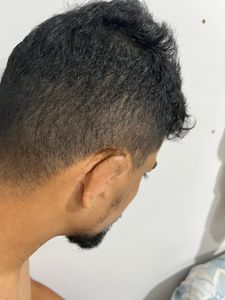 Saúde e Emergências - Tratamento e Cirurgia plástica da minha orelha 👂🏽🙏🏽