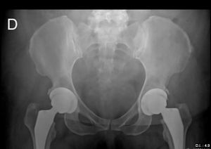 Olá meu nome é Eduardo, venho sofrendo com problema no quadril, preciso fazer uma cirurgia urgente
