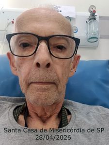 São Paulo/SP - Minha Luta Contra o Câncer e a Sarcopenia — Cada Ajuda é um Passo na Minha Cura