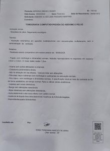 Adriana Simões - Corrente do Bem: Vaquinha pelo Tratamento Oncológico da Adriana