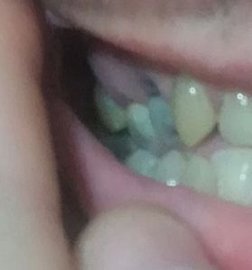 null - Ajuda para pagar tratamento dentário