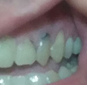 Saúde e Emergências - Ajuda para pagar tratamento dentário