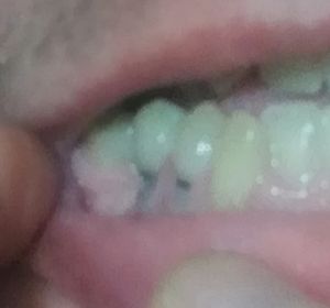 Ajuda para pagar tratamento dentário imagem 9