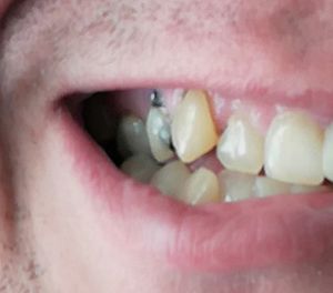 Ajuda para pagar tratamento dentário imagem 7