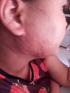 Financiamento Coletivo - Tratamento