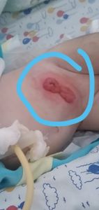 Vaquinha Online - Ajudar o bebê Daniel e sua família a voltarem para sua 