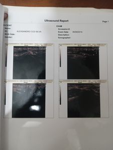 Saúde e Emergências - Cirurgia de hernia inguinal 