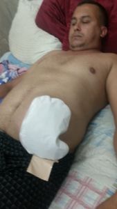 Vaquinha Online - Ajuda para realizar minha cirurgia de reconstrução do trânsito intestinal 