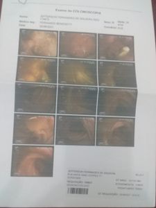 Saúde e Emergências - Ajuda para realizar minha cirurgia de reconstrução do trânsito intestinal 