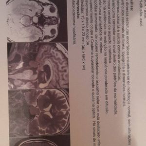 Vaquinha Online - Arrecadando fundos para parte da cirurgia do Tumor