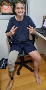 Gabriel Ferreira Galazzo - Gabriel quer viver e precisa de ajuda para combater o câncer!